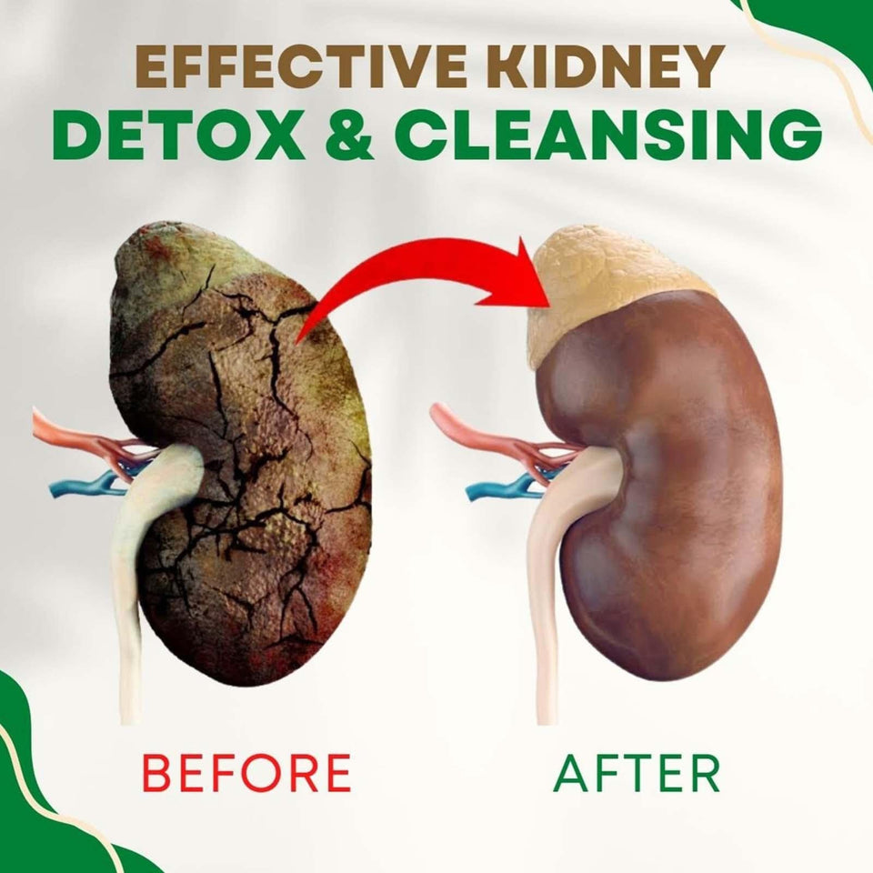 Kidney Support – suplemento para aliviar y proteger los riñones